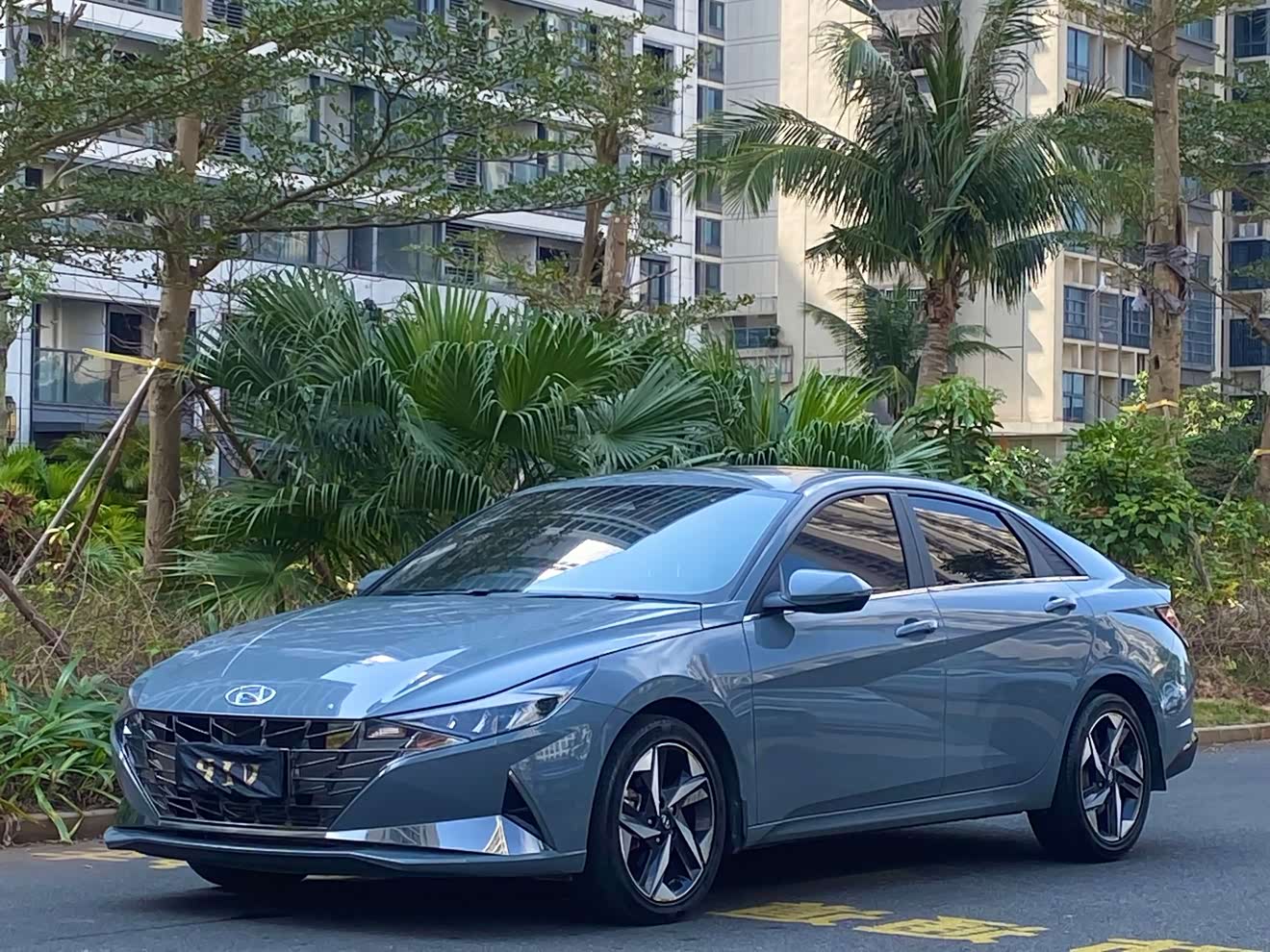 Hyundai Elantra 2022 Hyundai Elantra 2022 car image
